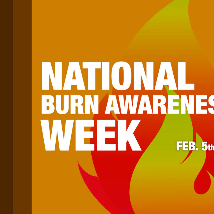 National Burn Awareness Week: How to Protect Yourself on the Job